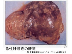 sumen_0043 第43話:寄生虫の話㉚