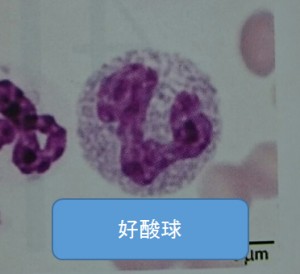 好酸球
